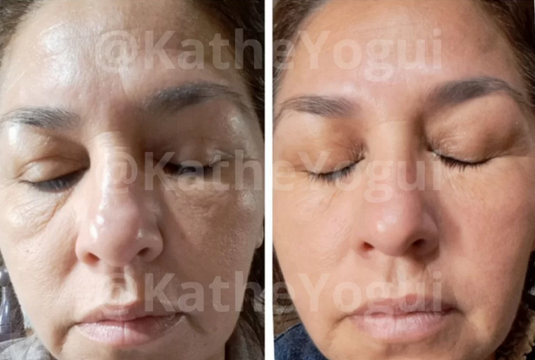 Yoga Facial & Drenaje Linfatico Kathe Yogui